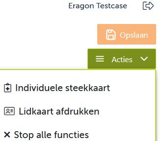Opslaan-knop en Acties menu